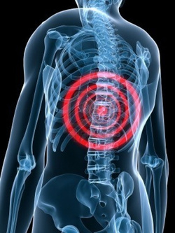 Виды и стадии межпозвонковой грыжи в грудном отделе