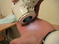Аппаратно-лазерная терапия - фото