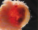 Яйцеклетка, прикрепленная к эндометрию - фото